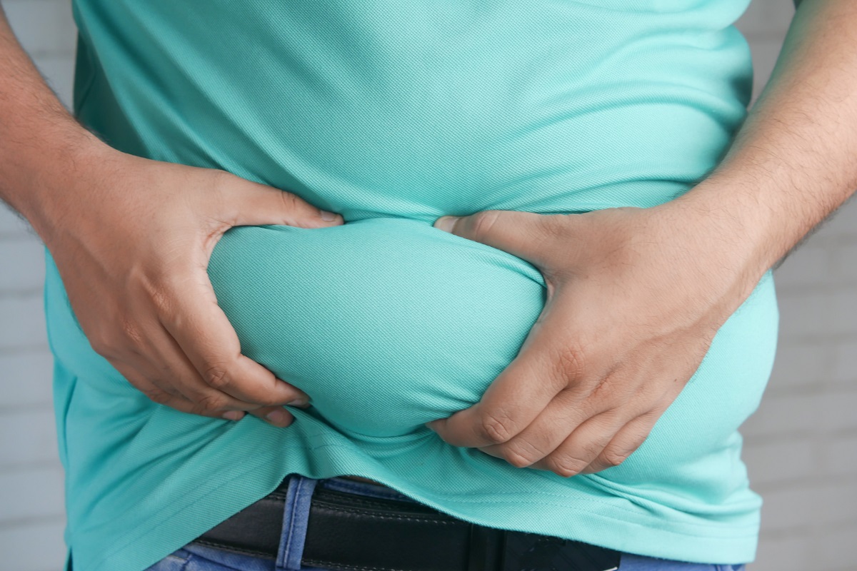 Pessoa segurando gordura localizada na região da barriga mostrando acúmulo de peso